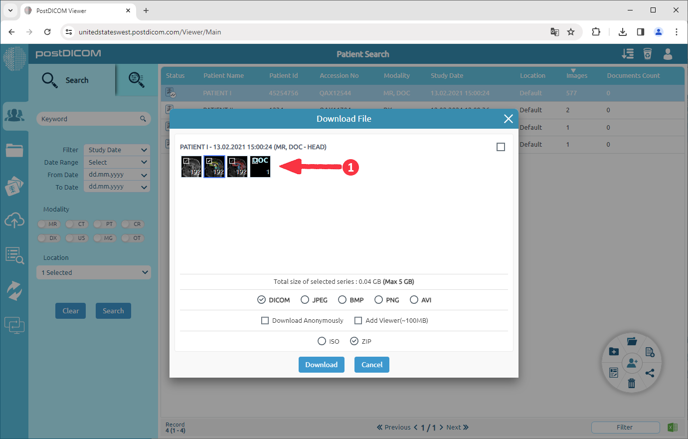 How to convert DICOM images to AVI