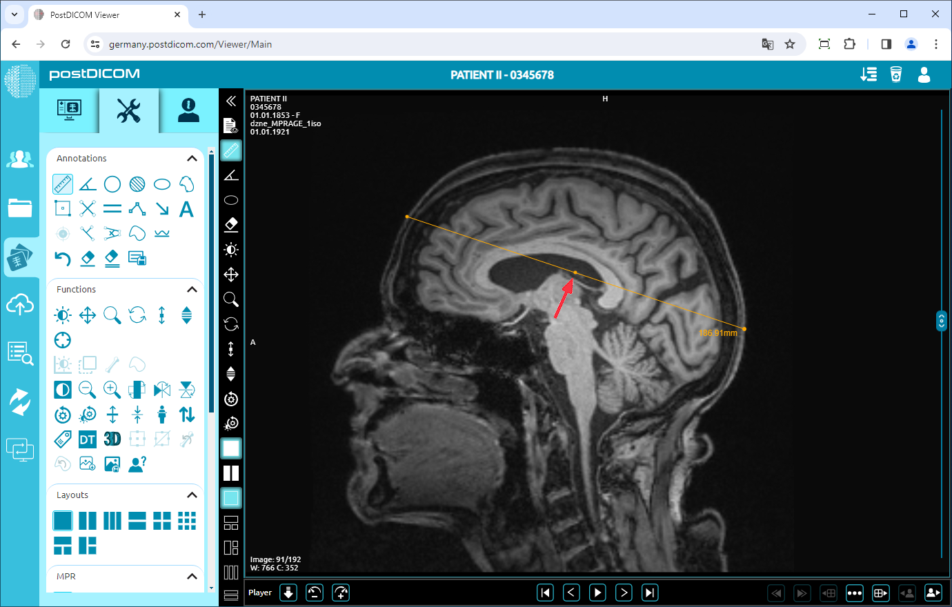 Using Distance Tool