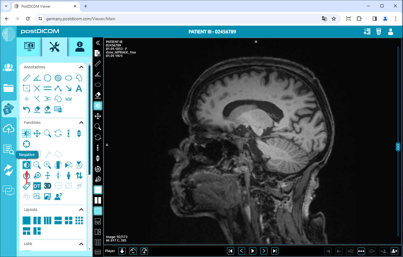 Using Negate, Rotate, Flip Vertical/Horizontal, Increase/Decrease Thickness, Zoom In/Out, Reset Functions