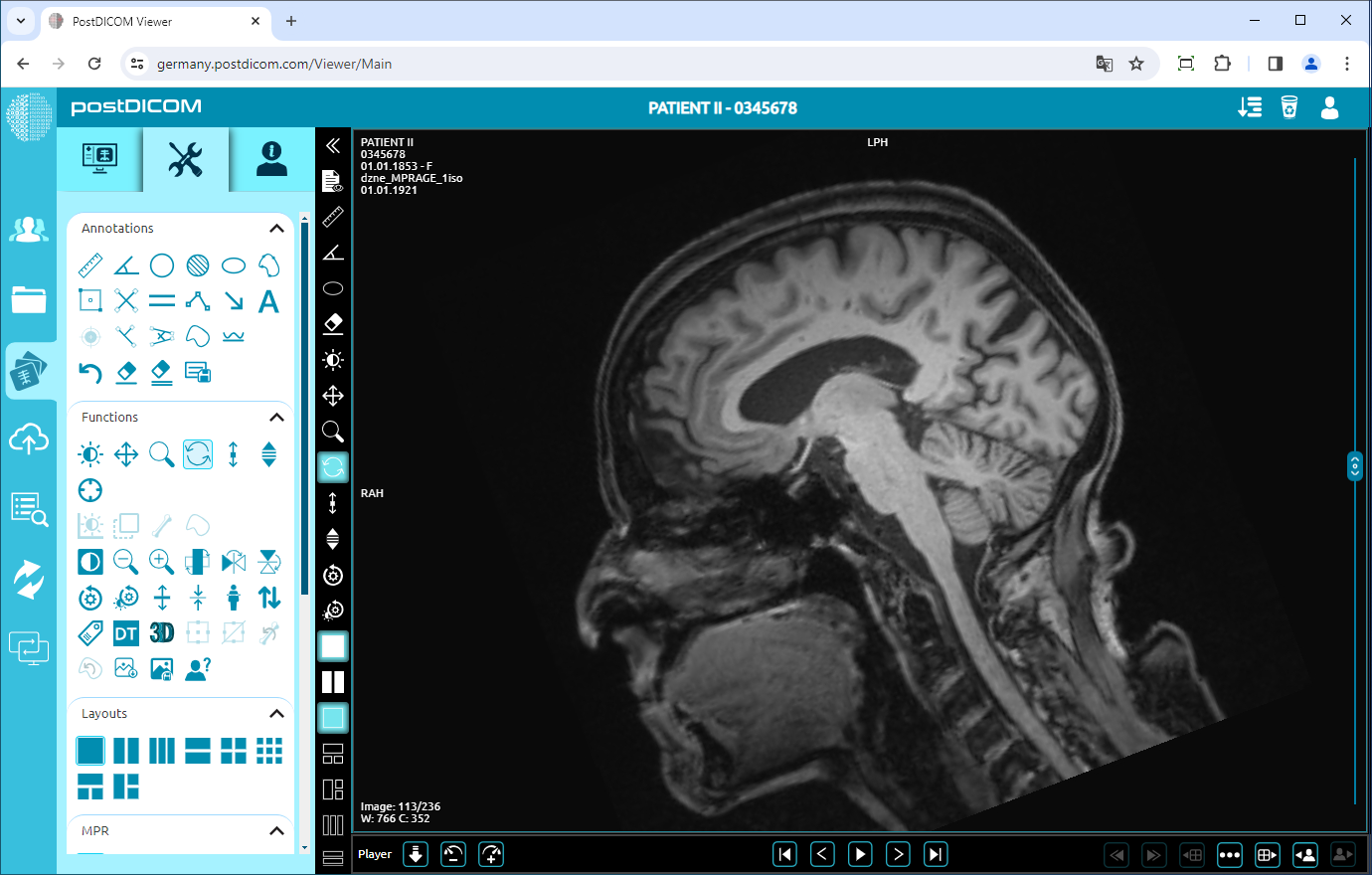 Using Window Level, Pan, Zoom, Rotation, Thickness and Scroll Functions