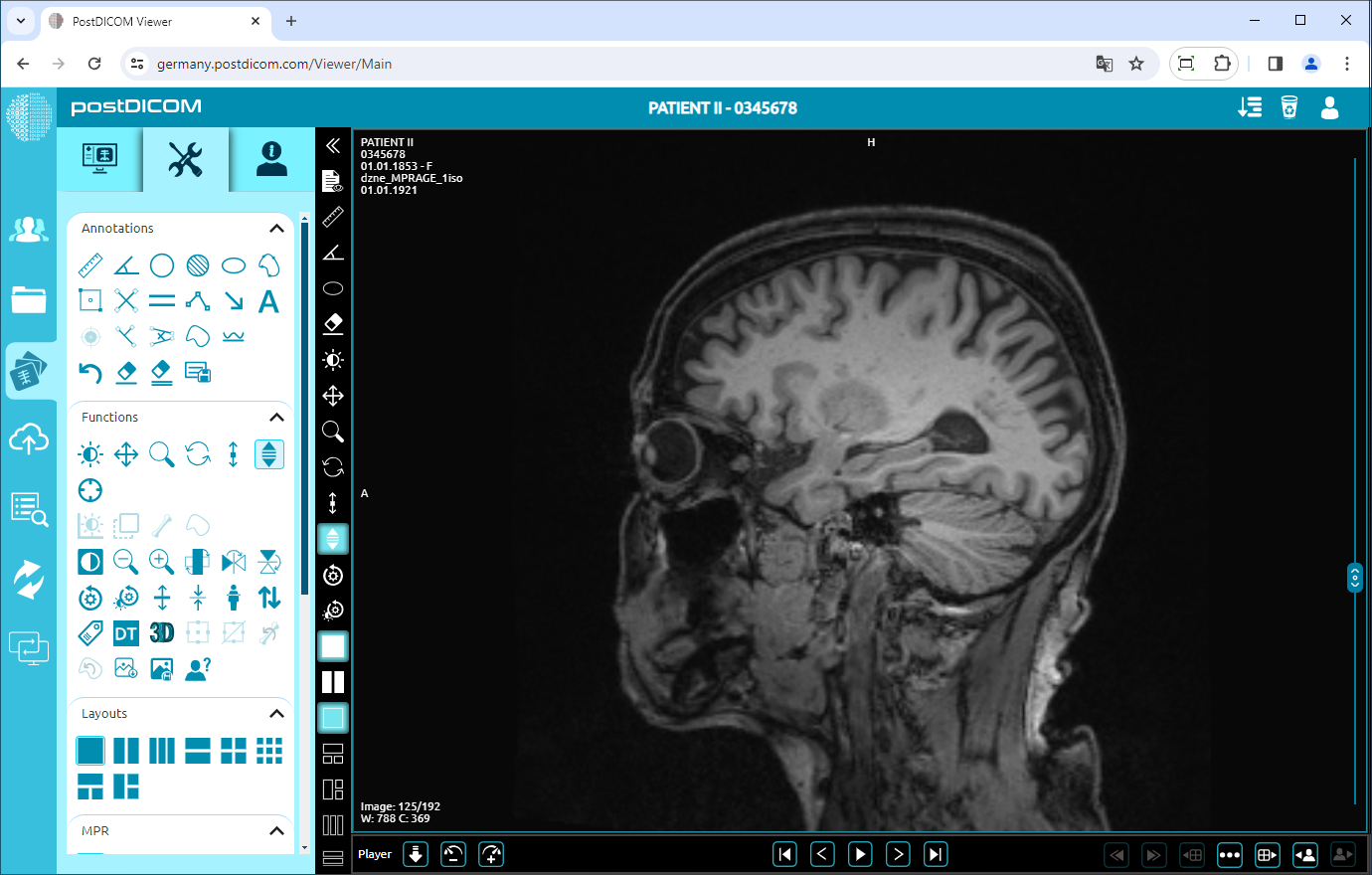 Using Window Level, Pan, Zoom, Rotation, Thickness and Scroll Functions