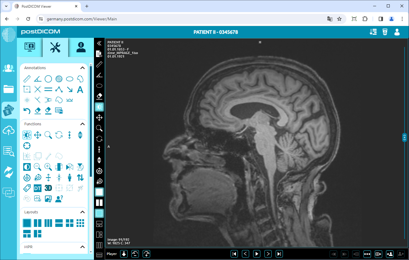 Using Window Level, Pan, Zoom, Rotation, Thickness and Scroll Functions